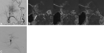 Fig 4.