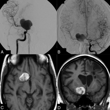Fig 2.