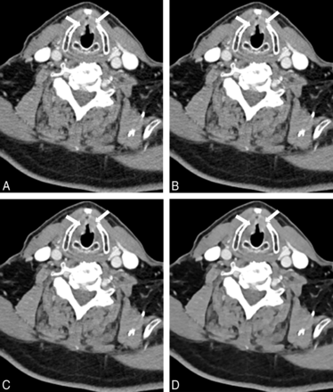 Fig 4.