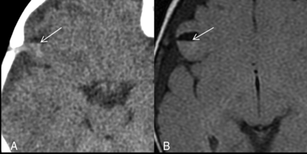 Fig 2.