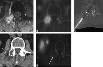 Fig 2.
