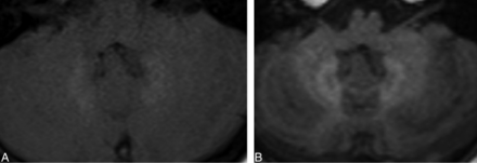 Fig 1.
