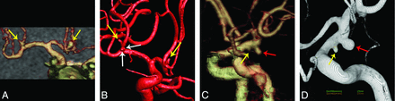 Fig 3.