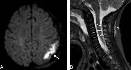 Fig 6.