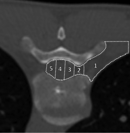 Fig 4.