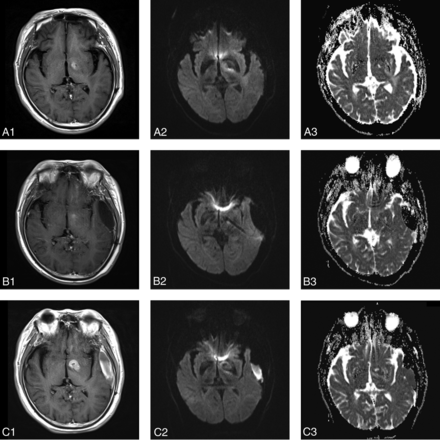Fig 3.
