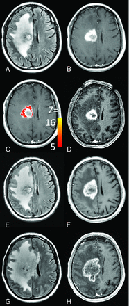 Fig 4.