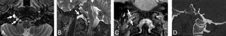 Fig 2.