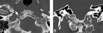 Fig 4.