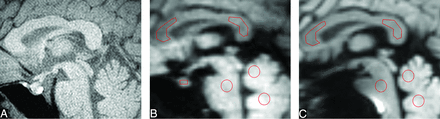Fig 1.