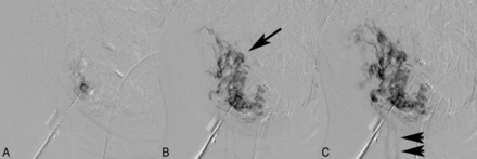 Fig 1.