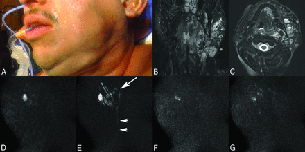 Fig 2.