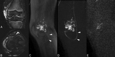 Fig 3.