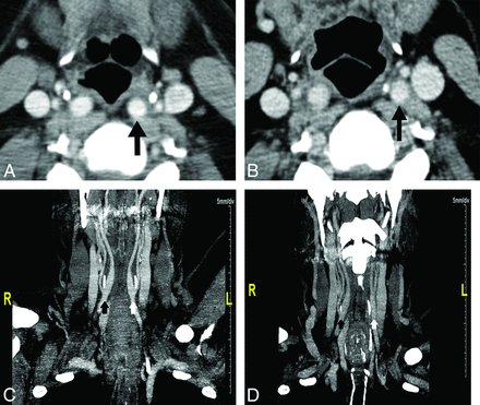 Fig 3.