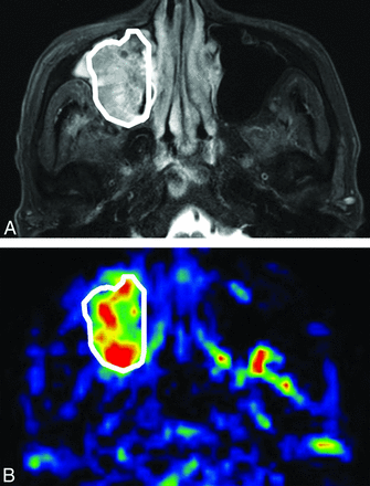 Fig 1.