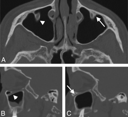 Fig 1.