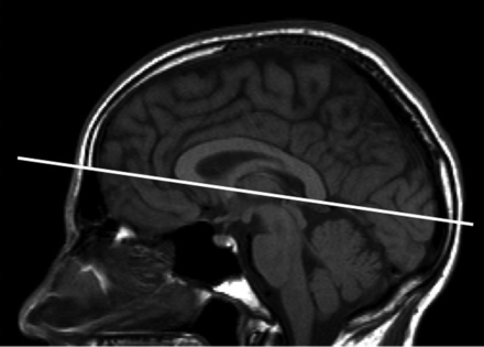 Fig 1.
