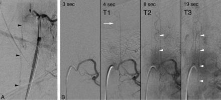 Fig 1.
