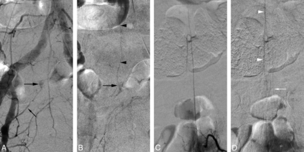 Fig 4.