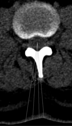 Fig 1.