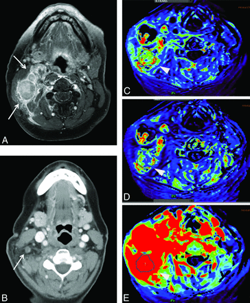 Fig 2.