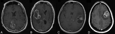 Fig 4.