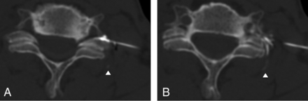 Fig 5.