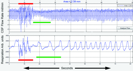 Fig 4.