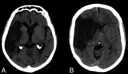 Fig 2.