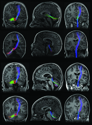 Fig 1.