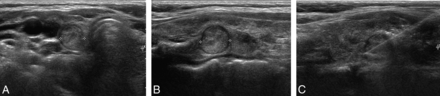 Fig 2.