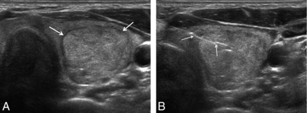 Fig 3.