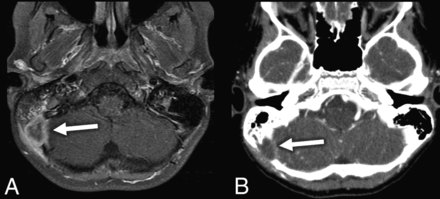 Fig 1.