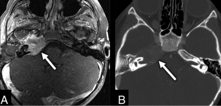 Fig 2.