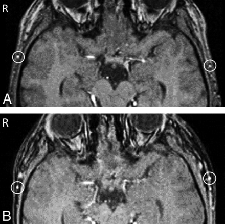 Fig 4.