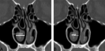 Fig 2.