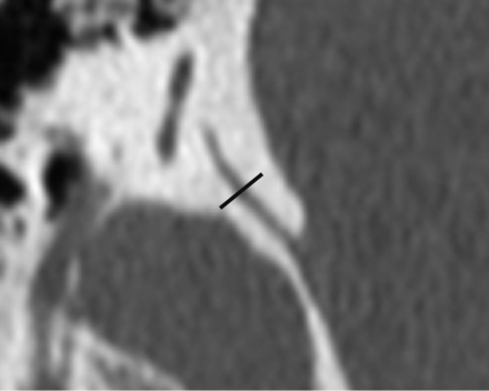 Fig 2.