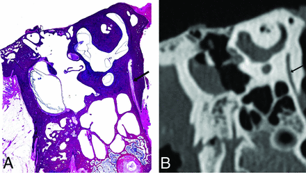 Fig 3.