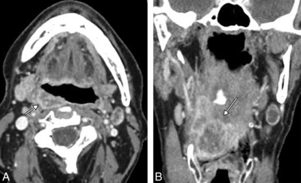 Fig 2.