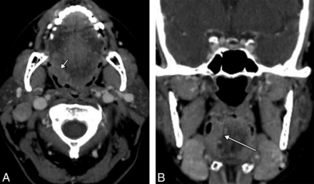 Fig 3.