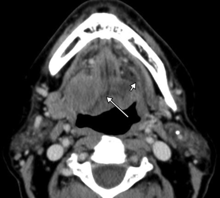 Fig 4.