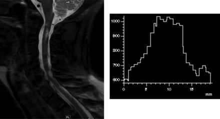 Fig 1.