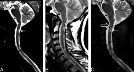 Fig 2.
