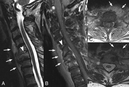 Fig 4.