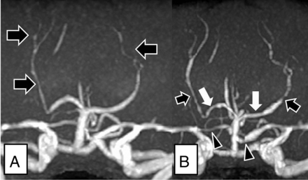 Fig 1.