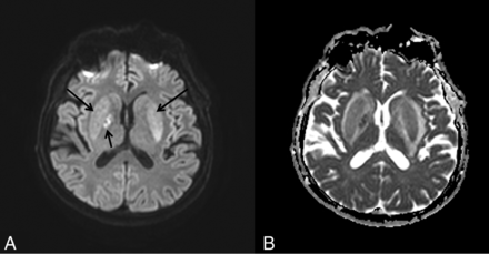 Fig 2.