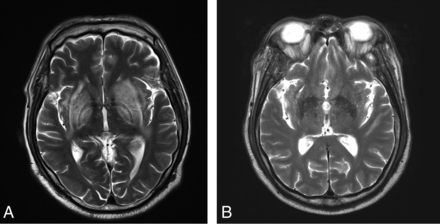 Fig 4.