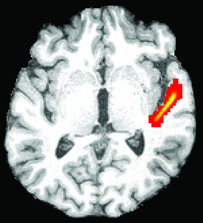 Fig 1.