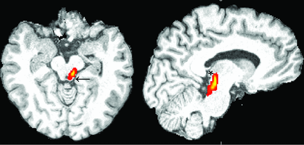 Fig 3.