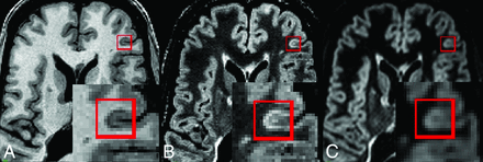 Fig 2.